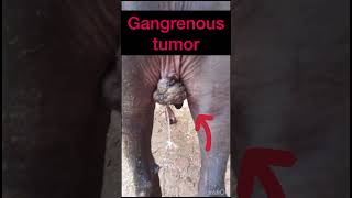 Gangrenous tumor l dr Umar khan [upl. by Adnawal]