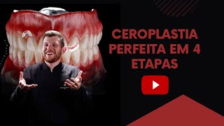 Ceroplastia Perfeita  Magno Sanches [upl. by Alister]