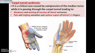 Overview of UL 14  Deep Fascia of Palm of the Hand  Dr Ahmed Farid [upl. by Sukcirdor]