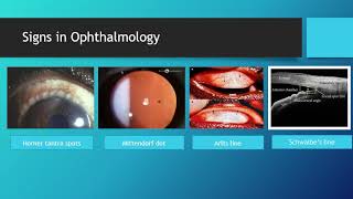 Clinic Symptomatology in ophthalmolgy Dr Divya [upl. by Joya]