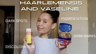 How to treat Dark marks Pigmentation Skin discoloration with Haarlemensis and Vaseline glassskin [upl. by Anetsirk]