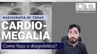 Todo Médico precisa saber fazer esse Diagnóstico na Radiografia  Galvani Filho [upl. by Tennes]