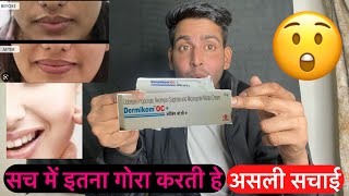 असली सचाई  Dermikem oc cream  dermikem oc cream review  dermikem oc cream ke fayde  Dermikem [upl. by Ursulina816]