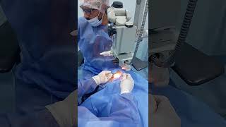 Operation for cataract for both eyes shorts [upl. by Gavrilla]