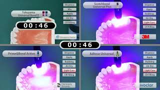 Direct restoration UNIVERSAL BOND II in comparison  TOKUYAMA DENTAL [upl. by Anitan135]