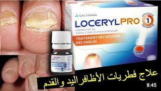 علاج فطريات الاظافر loceryl [upl. by Ecnarf219]