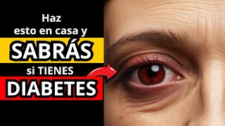 🔴¿CÓMO PUEDO SABER si TENGO DIABETES de forma CASERA 🤔🩺  ¡DESCUBRE LOS 5 SÍNTOMAS ⚠️🍬 [upl. by Eatnahc]