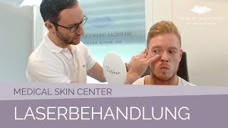 Laserbehandlung im Medical Skin Center – Dr Bacman [upl. by Nadabus]