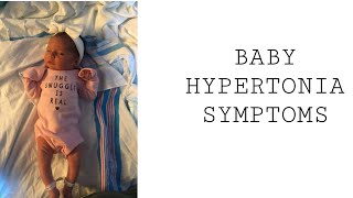 Baby Hypertonia Symptoms [upl. by Airotnes401]