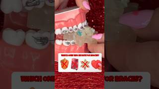 Are CRUNCHY CRYSTAL CANDIES safe for BRACES ASMR eating shorts braces asmr [upl. by Ennirak]