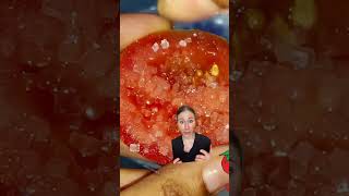 Tomato Scrub To Remove Dark Spots dermatologist [upl. by Roos323]