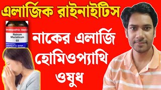 নাকের এলার্জি হোমিওপ্যাথি ঔষধ Allergic Rhinitis Homeopathic Treatment  অ্যালার্জিক রাইনাইটিস [upl. by Pierce]