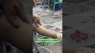 Spasticity is Velocity Dependent  Practical Demonstration [upl. by Saretta]