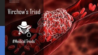 Virchows Triad of Thrombosis  Shorts MedicalTriads [upl. by Politi]