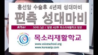 흉선암수술성대마비음성치료 목소리교정 발성치료음성재활 목소리가쉬었을때 Voice Therapy 목소리수술 성대보톡스 수술후목소리관리 voiceschoolㅣ목소리재활학교 음성치료후기 [upl. by Caine]