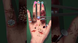 Hand Clin Doctor  Tile Blast [upl. by Halsey360]