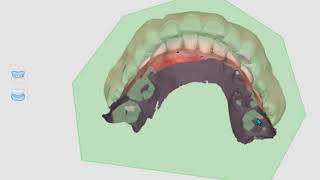 Features for Occlusion ENG [upl. by Lede]