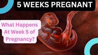 Pregnancy At Week 5  Pregnancy Week By Week  Wholesome Parenting [upl. by Thorr]