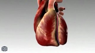 Heart attack and congestive Heart Failure in 3D [upl. by Gee]