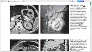 Peritoneum mesentery and abdominal wall imaging [upl. by Reppart733]