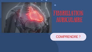 Comprendre la Fibrillation Auriculaire Explications et Exemples [upl. by Ym]