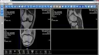 New HTML5 Zero Footprint DICOM Viewer in LEADTOOLS Version 18 [upl. by Hama]