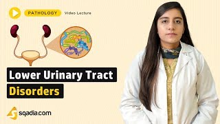 Lower Urinary Tract Disorders  Pathology Video Lectures  Medical Education  VLearning [upl. by Nedry]