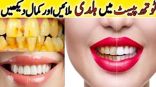 Fastest Way To Whiten Teeth At Home  What REALLY Works [upl. by Essej]