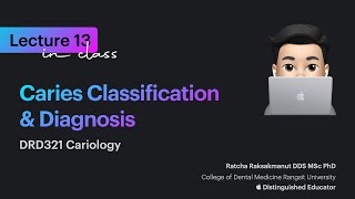 Caries Classification amp Diagnosis [upl. by Beverlee]