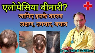 Alopecia bimari ka ilaj l alopecia bimari ke lakshan l alopecia areata kya hai [upl. by Nevur184]