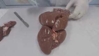 Kidney Dissection [upl. by Starr]