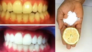 How to remove dental plaque get a white teeth in 5 minutes [upl. by Dumah132]