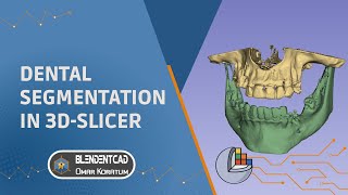 Dental DICOM Segmentation using 3DSlicer [upl. by Ecnerewal]