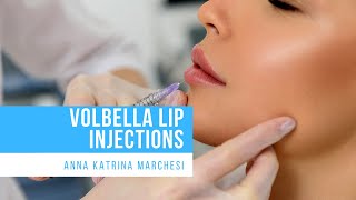 Volbella Lip Injections at Bruno Brown Plastic Surgery [upl. by Lonier294]