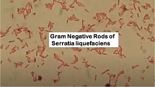 Serratia liquefaciens in Gram Staining of Culture [upl. by Xuaegram]