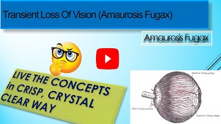 Transient Loss Of Vision Amaurosis Fugax [upl. by Odlabu430]