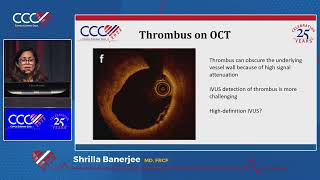 Intrav Imaging in MINOCA When to Use Index of Microcirculatory Resistance IMR Shrilla Banerjee MD [upl. by Marie-Jeanne91]