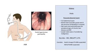 Reason for Blood in Stool  Causes and Treatment in Hindi [upl. by Htebasyle215]