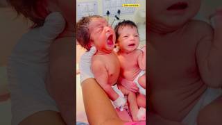 Twin newborn baby different type placentanewbornbabybabycuteviralvideo [upl. by Michaud161]