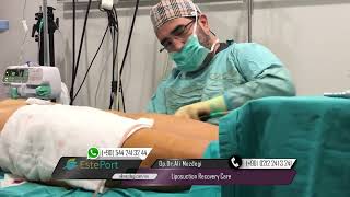 Liposuction Recovery Care [upl. by Nilyaj601]