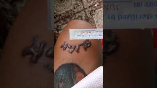 popping blisters 1st daypicosecond laser pen tattoo removal NEATCELL [upl. by Nayar457]