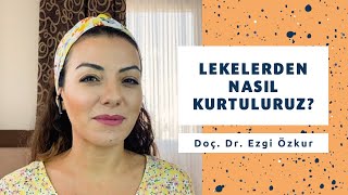 Lekelerden Nasıl Kurtuluruz Lekeler Nasıl Geçer  Doç Dr Ezgi Özkur [upl. by Alvira]