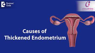 What causes Endometrial thickness  DrSmitha Sha of Cloudnine Hospitals  Doctors Circle [upl. by Aned951]