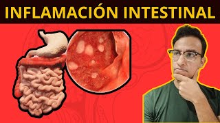 5 COSAS QUE TE INFLAMAN EL INTESTINO Síndrome de Intestino Irritable [upl. by Donelle]