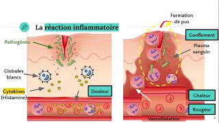 La réaction inflammatoire 🔥 [upl. by Caprice295]