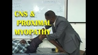 CNS EXAMINATION  PROXIMAL MYOPATHY DR SALAH PACES CENTER [upl. by Burrow]