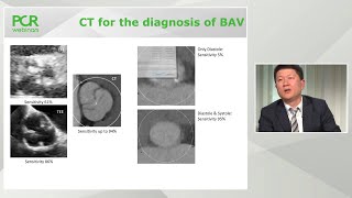 TAVI in bicuspid valve disease  PCR Webinar Round Table [upl. by Xila]