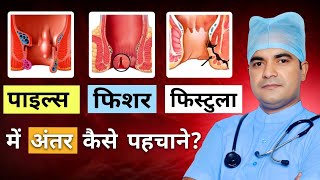 piles fissure fistula mein kya antar hai  piles fissure fistula  piles fissure fistula difference [upl. by Nanice767]