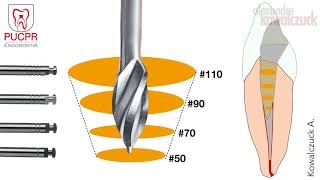 Técnica de Preparo Manual do Canal Radicular  Endodontia PUCPR [upl. by Gabriello440]