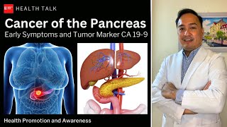 Cancer of the Pancreas Early symptoms and tumor marker CA 199 [upl. by Dorej]